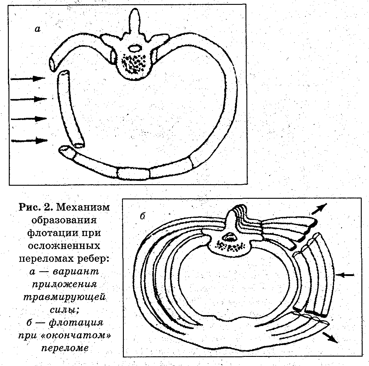 Выполните наложение окклюзионной повязки при проникающем ранении грудной клетки. - student2.ru