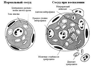 экссудация жидкости - student2.ru