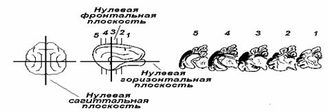 занятие 5. механизмы торможения нейронов. физиология двигательной функции. клинико-физиоло­гические методы изучения функций цнс. итоговое занятие - student2.ru