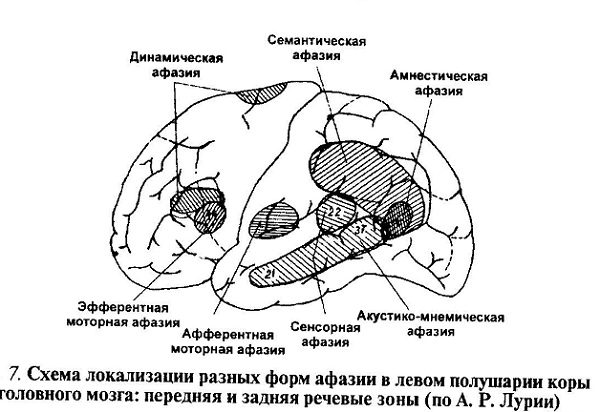 Моторная афазия афферентного типа - student2.ru