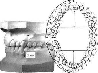 аномалии окклюзии пар зубов-ан­тагонистов - student2.ru