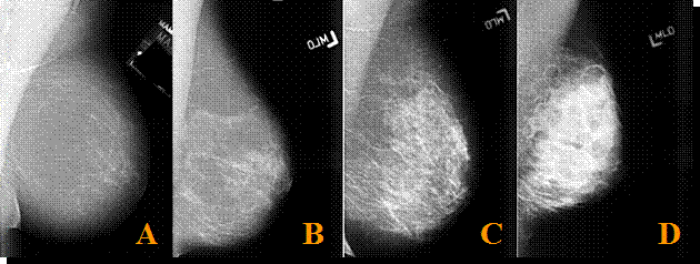диагностические критерии bi-rads для маммографии - student2.ru