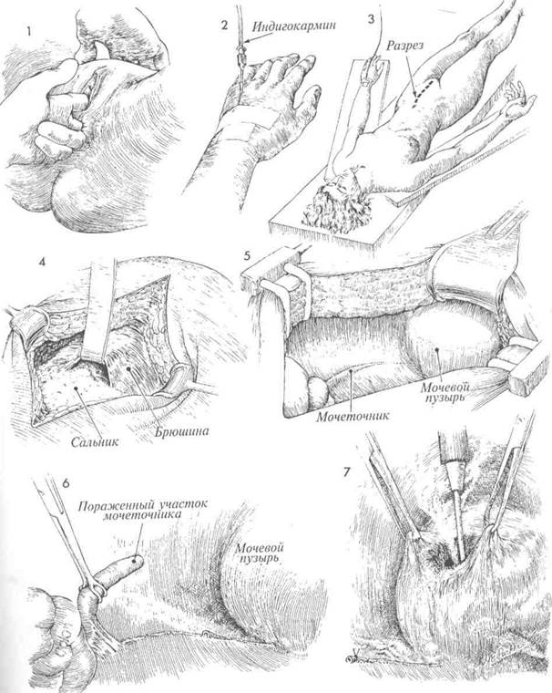 и с использованием лоскута мочевого пузыря - student2.ru