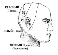 Исследование сухожильных рефлексов - student2.ru