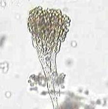 Кандиды (род Candida) Candida spp. - student2.ru