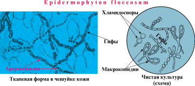 Кандиды (род Candida) Candida spp. - student2.ru