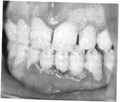 Классификация заболеваний пародонта - student2.ru