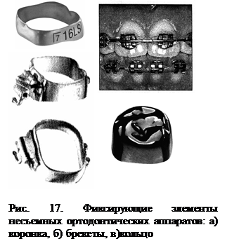 Конструктивные части ортодонтических аппаратов - student2.ru