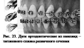 Конструктивные части ортодонтических аппаратов - student2.ru