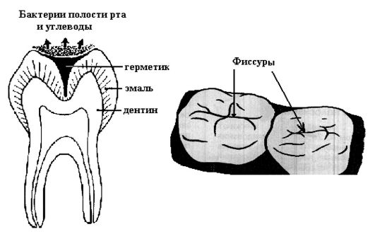 лекция 28 материалы для профилактики стоматологических заболеваний - student2.ru