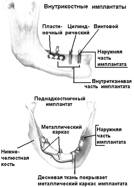 лекция 29 материалы для пломбирования корневых каналов зубов - student2.ru