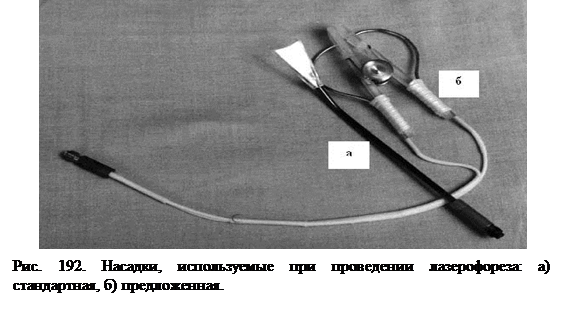 Методы оптимизации активного периода ортодонтического лечения - student2.ru