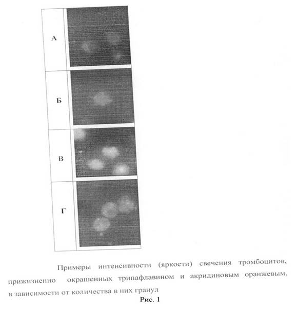 Морфофункциональная оценка тромбоцитов с помощью фазово- интерференционной микроскопии. - student2.ru