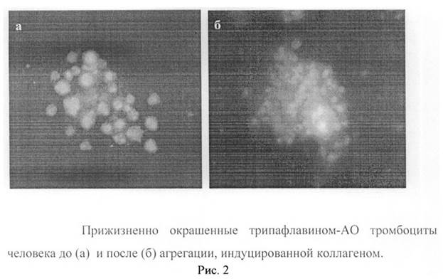 Морфофункциональная оценка тромбоцитов с помощью фазово- интерференционной микроскопии. - student2.ru