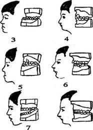Определение возраста по стертости зубов верхней челюсти (по М. М. Герасимову, 1955) - student2.ru