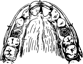 Ортодонтические аппараты механического типа действия. - student2.ru