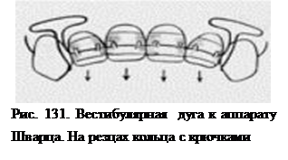 открытый прикус - student2.ru