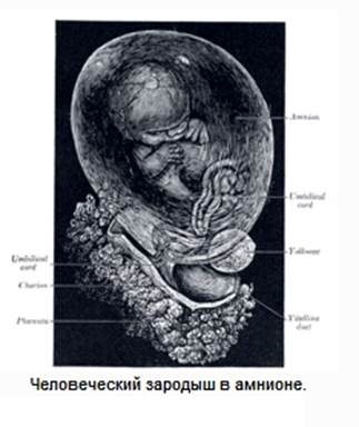 патология пупочного канатика - student2.ru