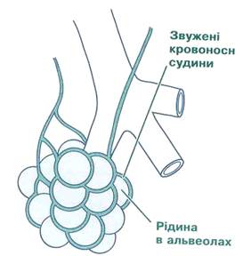 Перестройка дыхательной и сердечно-сосудистой систем после рождения - student2.ru