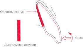 Распределение силы и типы перемещения зубов - student2.ru