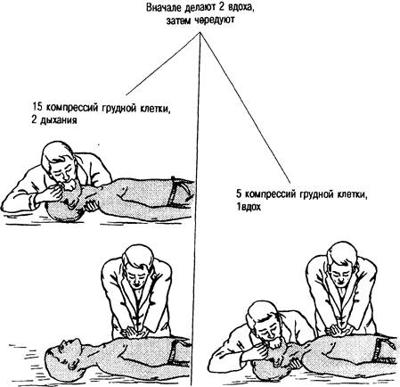 Схема 32.1. Алгоритм искусственного дыхания - student2.ru