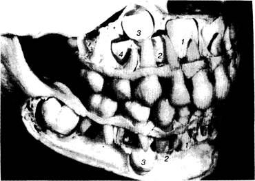 Сроки закладки, формирования и минерализации временных зубов - student2.ru