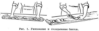 Техника наложения гипсовых повязок - student2.ru