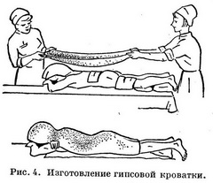 Техника наложения гипсовых повязок - student2.ru