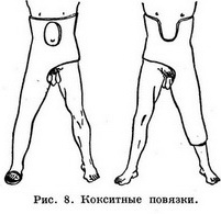 Техника наложения гипсовых повязок - student2.ru