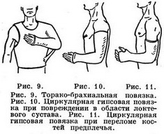 Техника наложения гипсовых повязок - student2.ru