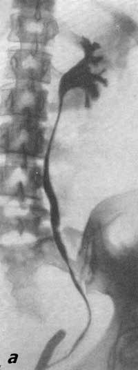Высота основного томографического среза при исследовании органов мочеполовой системы - student2.ru