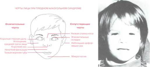 Этапы черепно-лицевого развития эмбриона - student2.ru