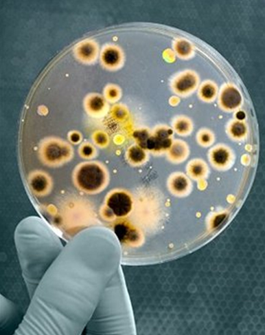 Исследование мокроты на микобактерии туберкулеза (BK) - student2.ru