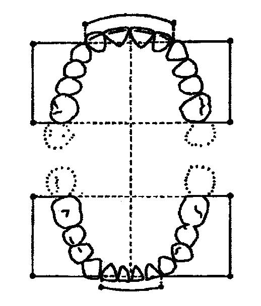 Измерение длины переднего отрезка зубных рядов. Дж. Коркхауз - student2.ru