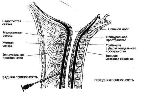 А. Идентификация эпидурального пространства - student2.ru