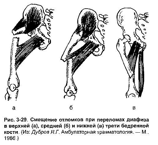 Анатомические особенности нижней конечности - student2.ru