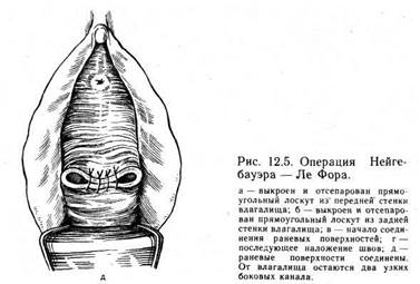 аномалии положения половых органов - student2.ru