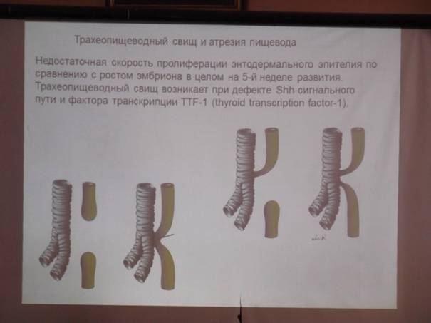 аномалии развития органов полости рта - student2.ru