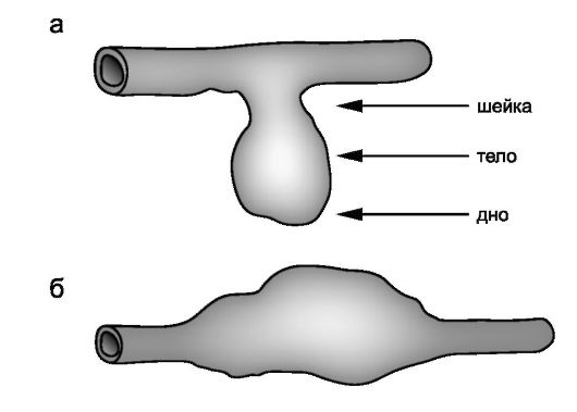 аномалии сосудов головного мозга - student2.ru