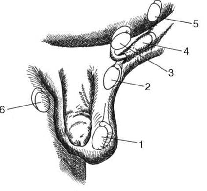Аномалии яичек - student2.ru