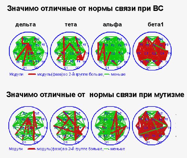 асимметрия когерентности ээг при посткоматозных бессознательных состояниях после тяжелой черепно-мозговой травмы - student2.ru