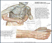 Аспирация инородных тел - student2.ru