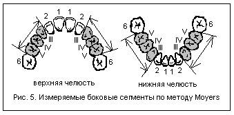 Б) Метод Moyers (методика Мичиганского университета) - student2.ru