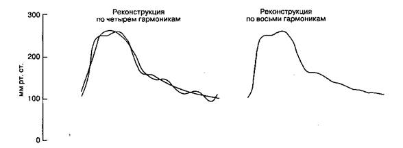 Б. Методика катетеризации лучевой артерии - student2.ru