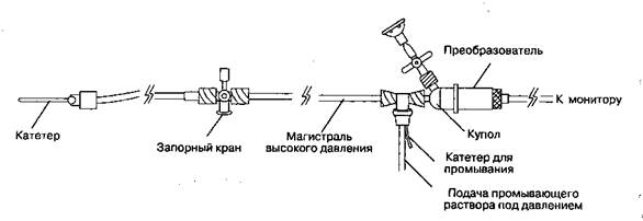 Б. Методика катетеризации лучевой артерии. - student2.ru