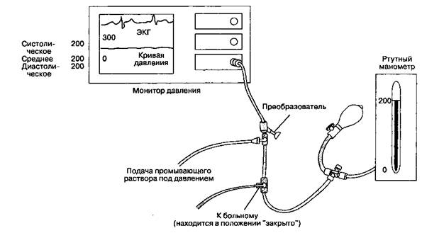 Б. Методика катетеризации лучевой артерии. - student2.ru