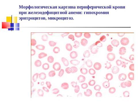 Биохимические показатели крови - student2.ru