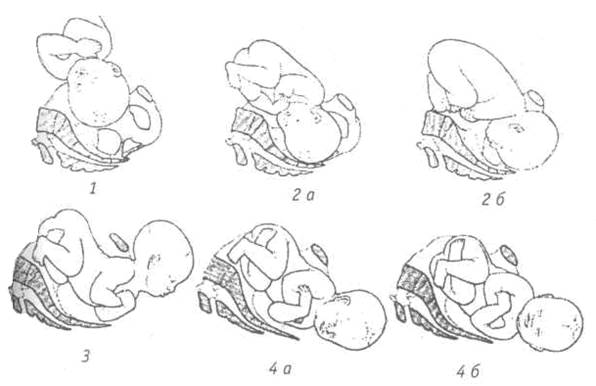 Биомеханизм родов при переднем виде затылочного предлежания - student2.ru