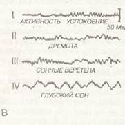 бодрствование, сознание, сон - student2.ru