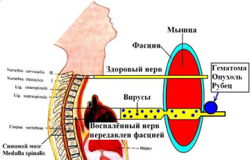 Целители лечат «больной» орган массажем до тех пор, пока аорта не займёт центральное положение на гребне позвоночника. - student2.ru